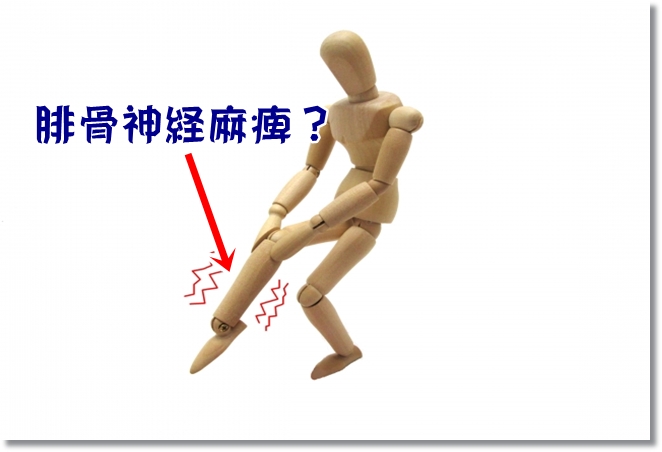 足にしびれが？腓骨神経麻痺？足根管症候群？