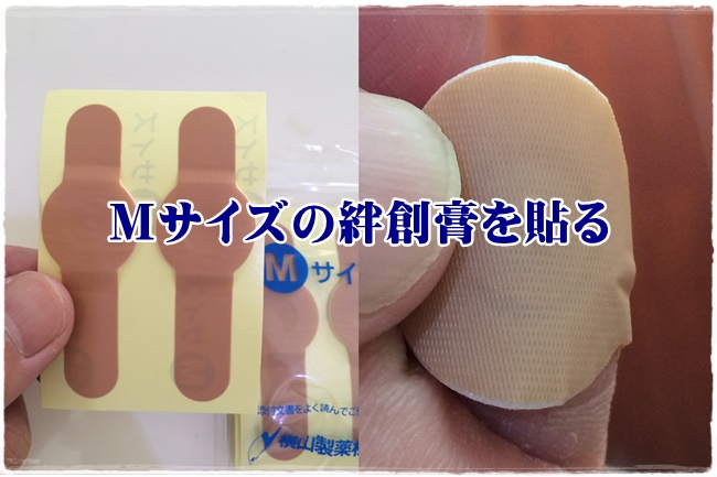 足指のイボをイボコロリで取れるかどうかを体験！