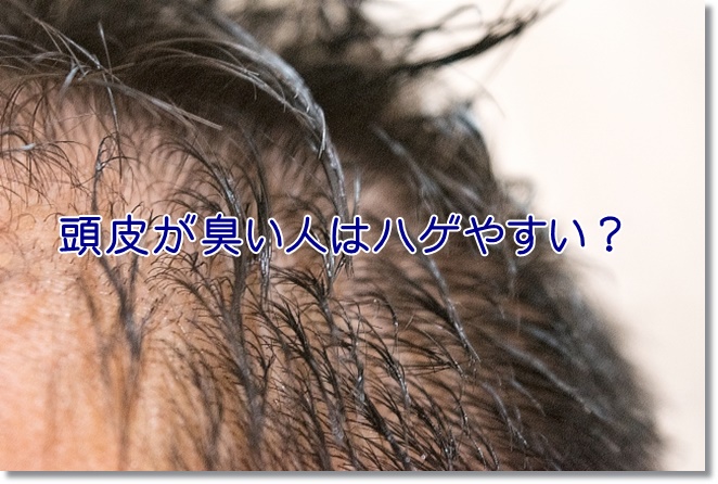 頭皮が臭い人はハゲやすい？脂漏性皮膚炎だとしたら大変！