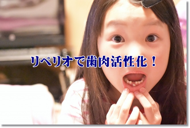 リペリオで歯肉活性化！リペリオの効果と使い方を再確認
