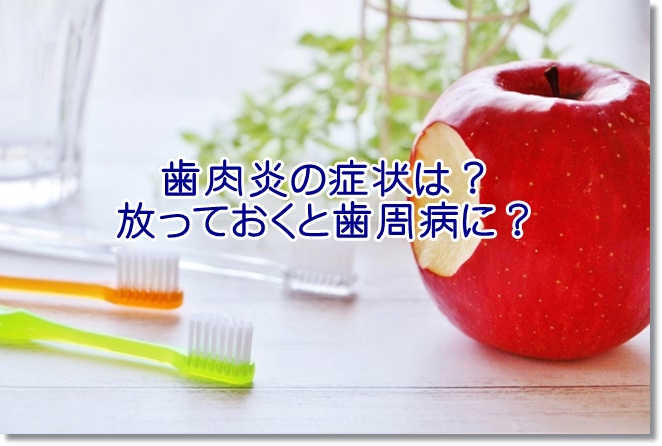歯肉炎の症状は？放っておくと歯周病に？