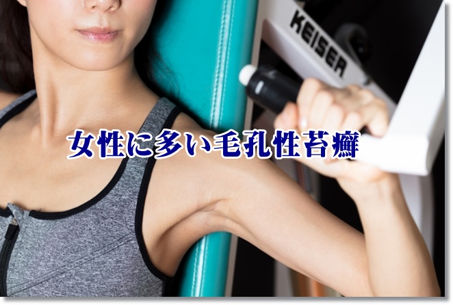 二の腕のブツブツは毛孔性苔癬？原因と症状は？ブツブツがあると悪印象！？