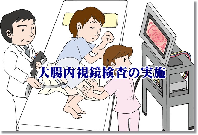 大腸内視鏡検査を体験！時間と費用は？オナラが出ない！