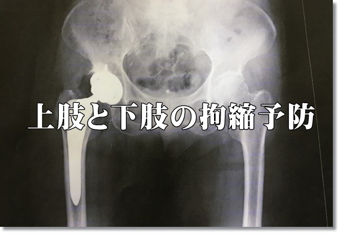 上肢と下肢の拘縮予防に関する配慮点について