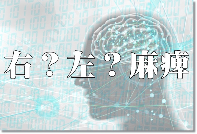 「明日麻痺になる！」と言われたら、どっちの麻痺を選ぶ？
