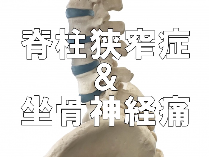 歩いたら腰痛としびれが…！これって脊柱管狭窄症？